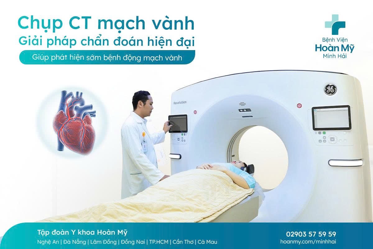 Chụp CT mạch vành: Giải pháp chẩn đoán hiện đại giúp phát hiện sớm bệnh động mạch vành